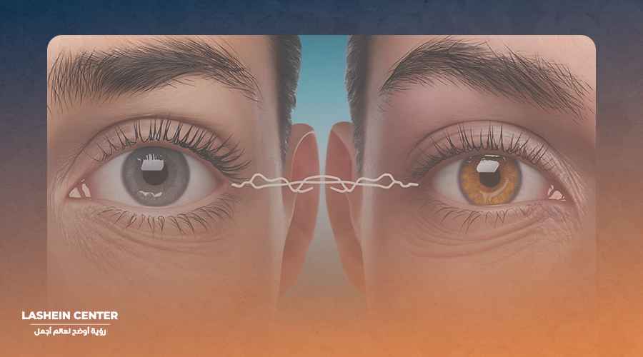 زرع قرانيه بجميع انواعها