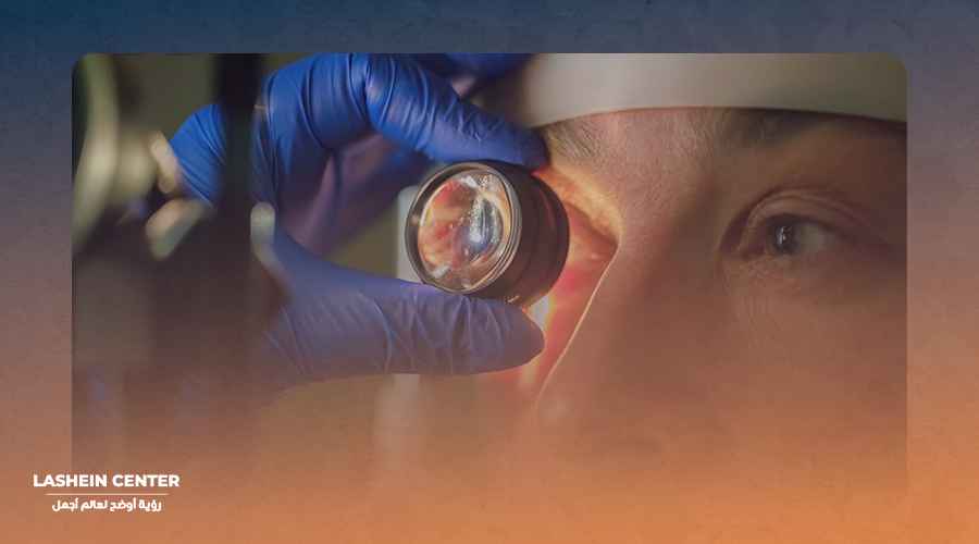 تصوير القرنيه بنتكام