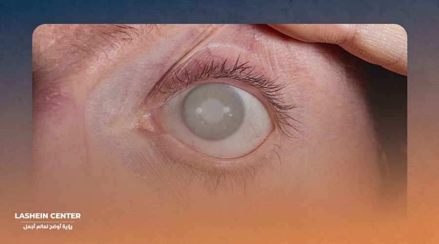 عملية المياه الزرقاء